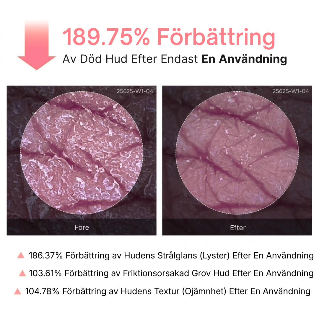Peel Shot – Förnyad Hudkänsla