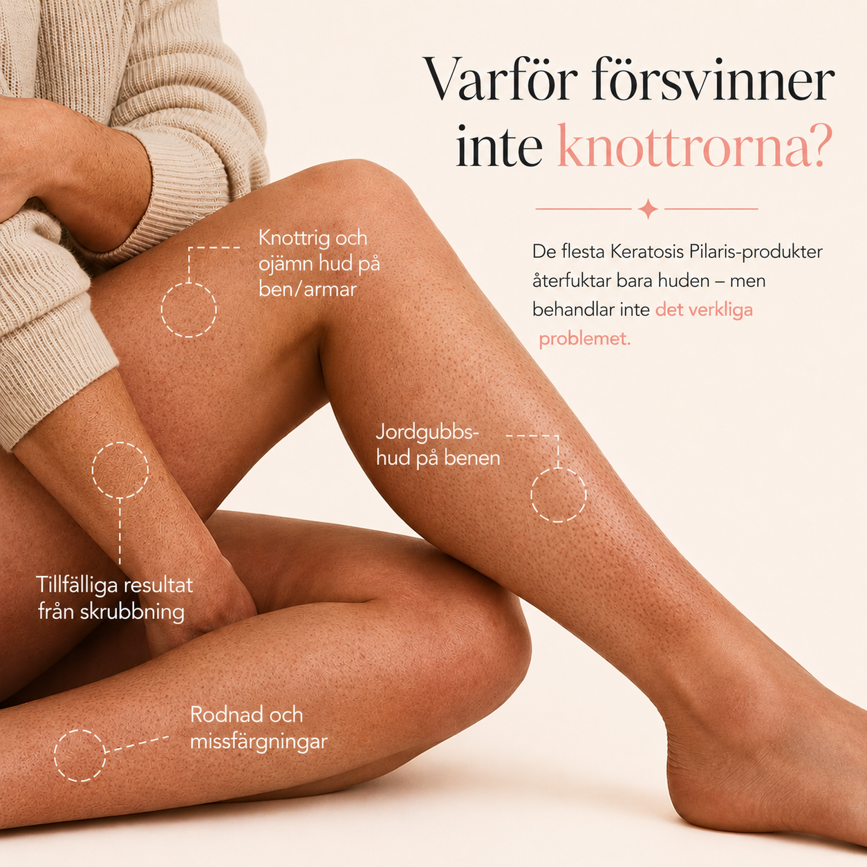 KP kräm – Jämnar ut knottrig hud