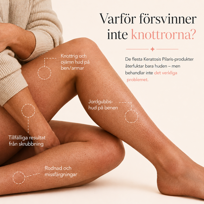 KP kräm – Jämnar ut knottrig hud