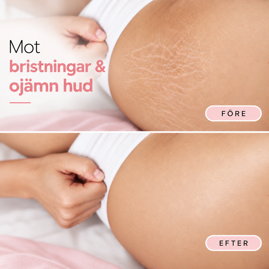 BetterSkin Body Oil
