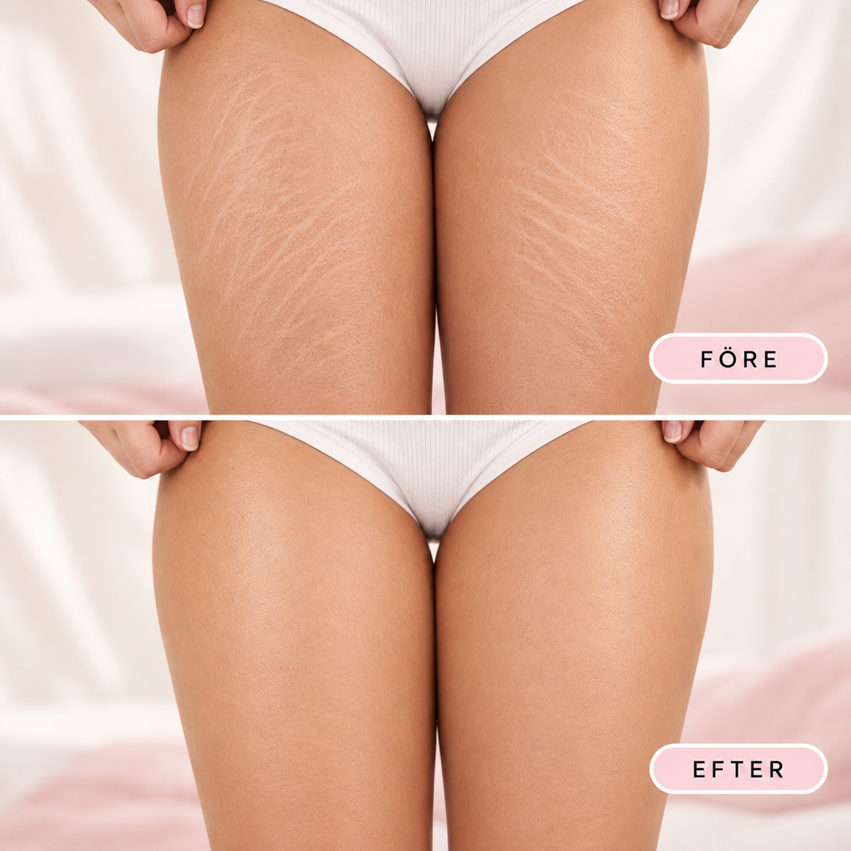 BetterSkin Body Oil